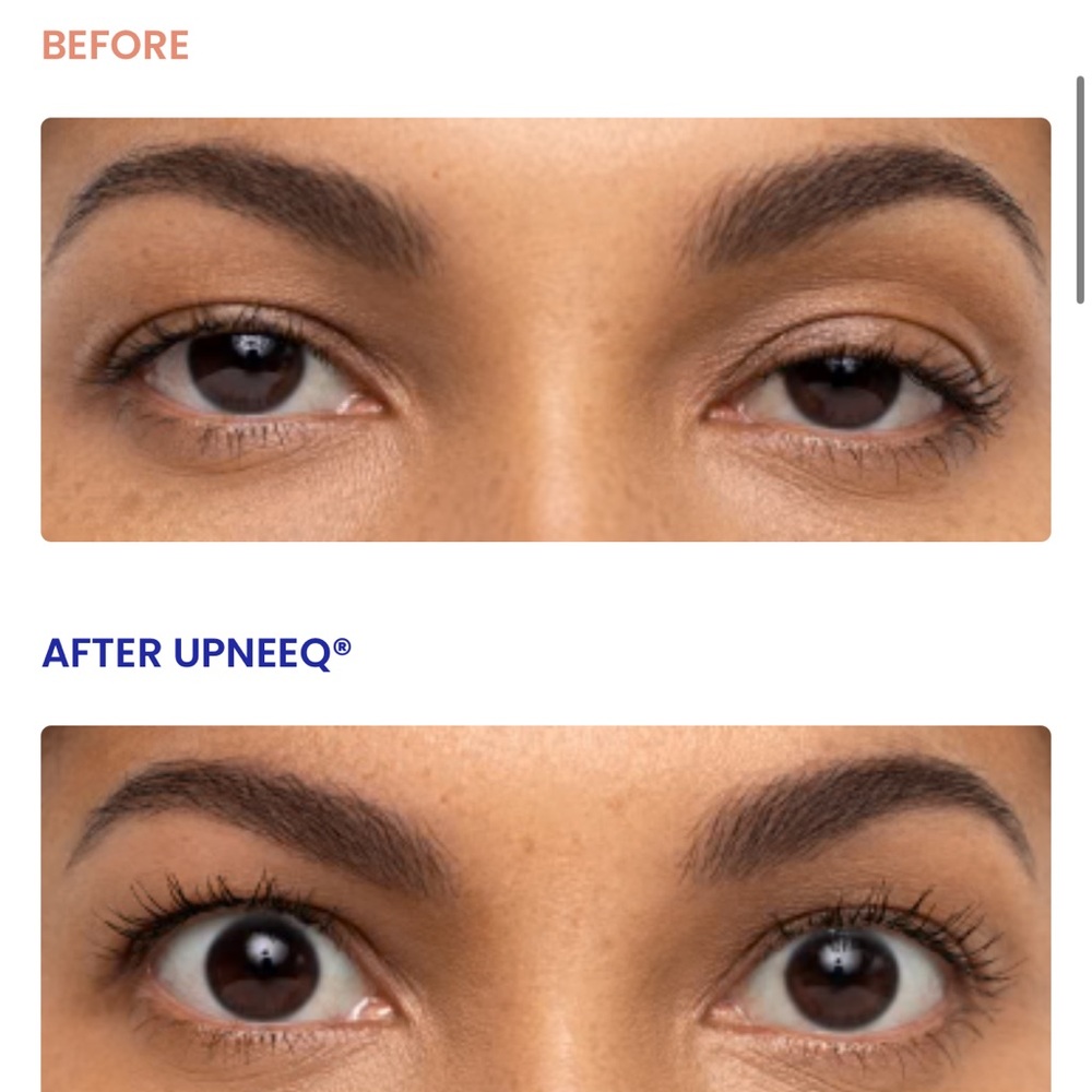 UPNEEQ Eye Drops - set of 2 - Picture 6 of 7
